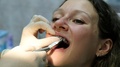 Visit To The Dentist, Installation Of The Bracket System. Orthodontist Installs