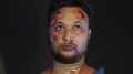Bloody Fake Injuries On Man's Face Made By Professional Make Up Artist