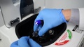 Medical Doctor Preparing Blood For Spinning Machine Platelet Rich Plasma