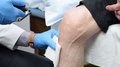 Medical Doctor Preparing And Injecting Platelet Rich Plasma Prp Into