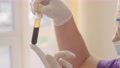 Platelet-Rich Plasma Preparation. Tube With Blood In Hands.