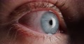 Pond5 Red eye with blue iris of tired guy looking around in complete exhaustion -